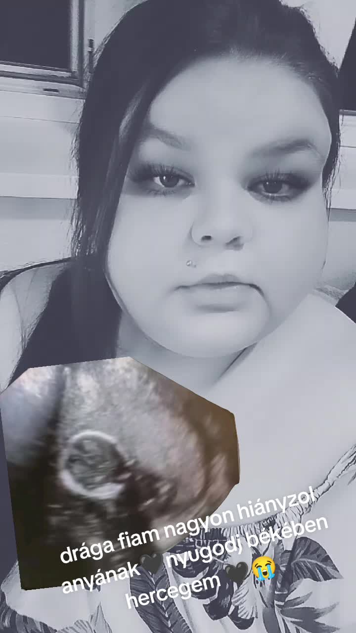 @𝙁𝙡𝙚𝙜𝙢𝙖𝘾𝙨𝙖𝙟𝙨𝙯𝙞
