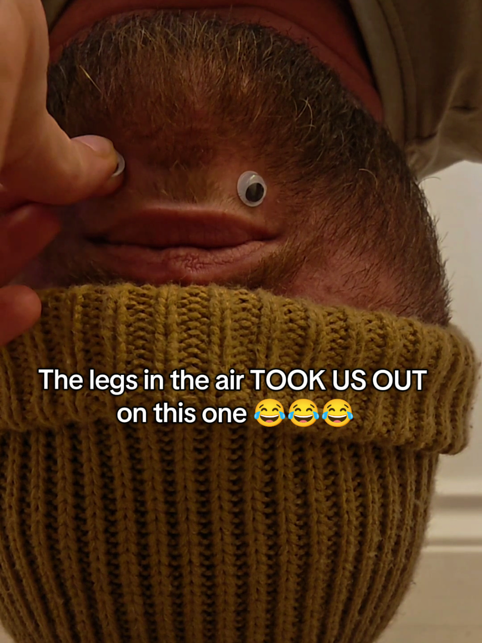 @Chinfaced
