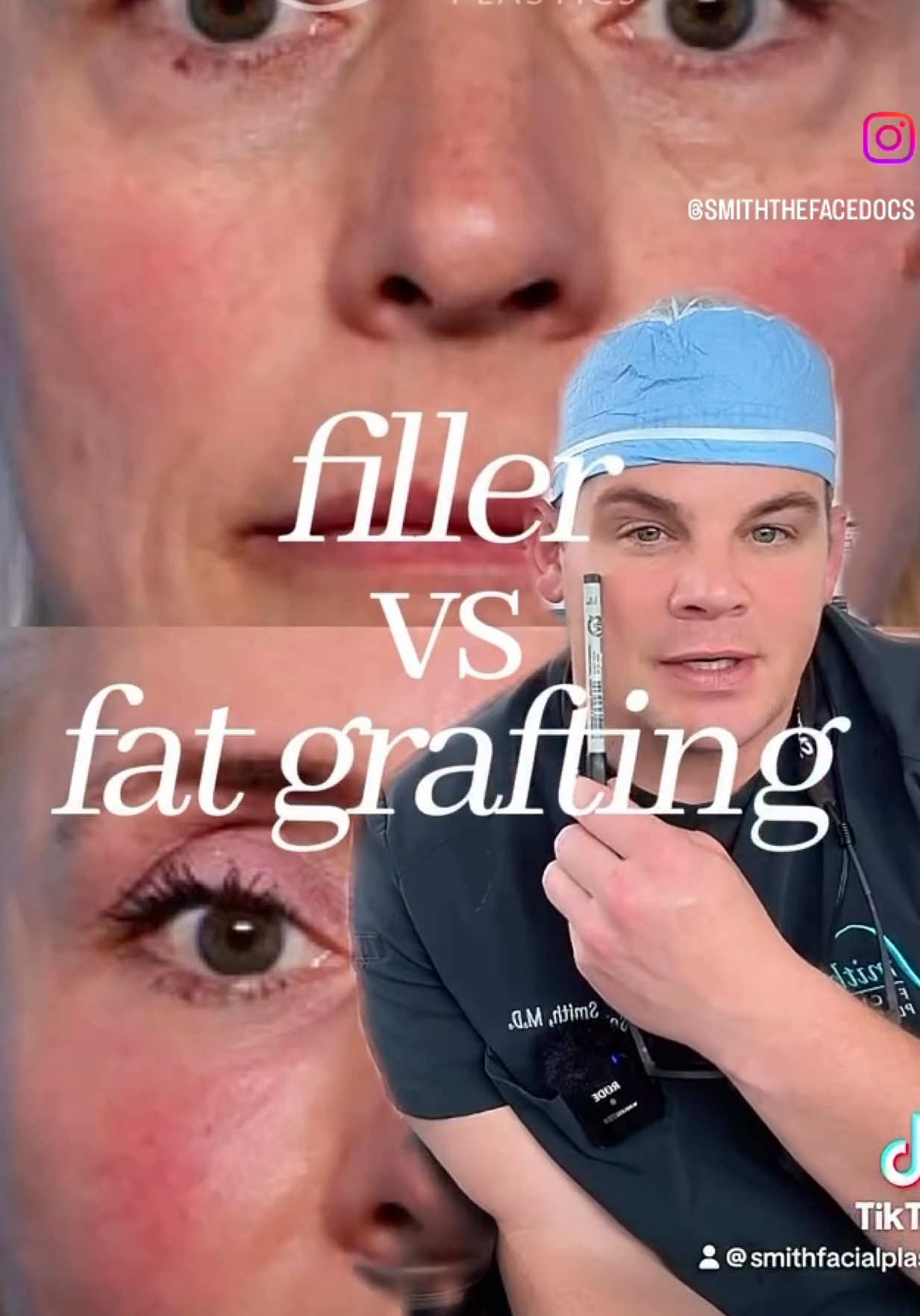 @Smith Facial Plastics