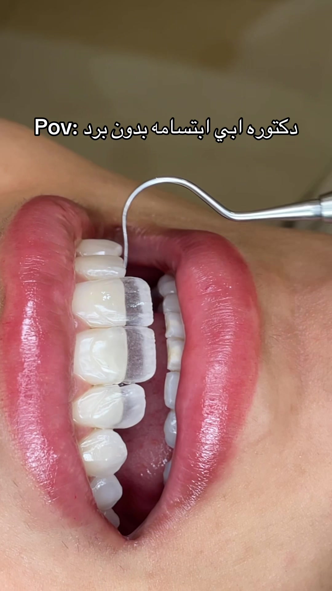 @Dr. Abrar Alhababi