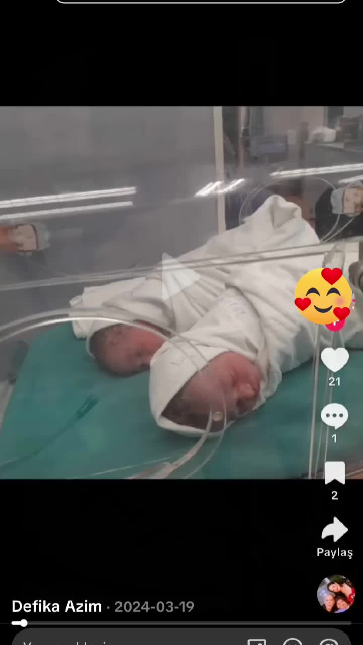 @gnaü meyem