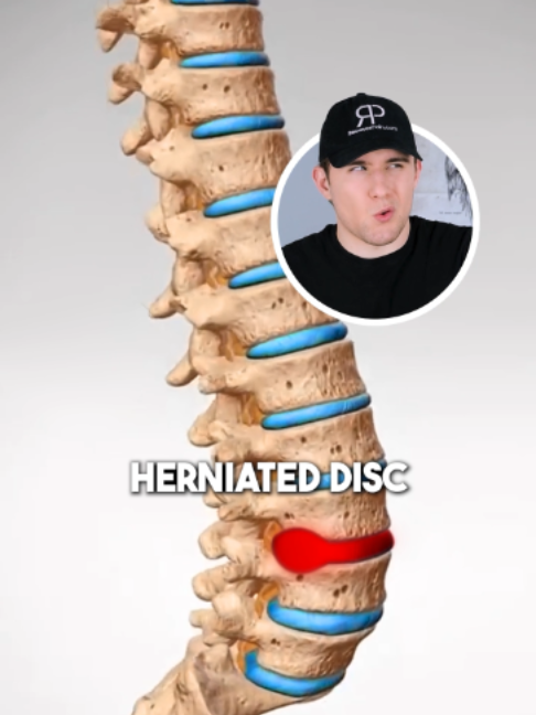 @Recover Pain