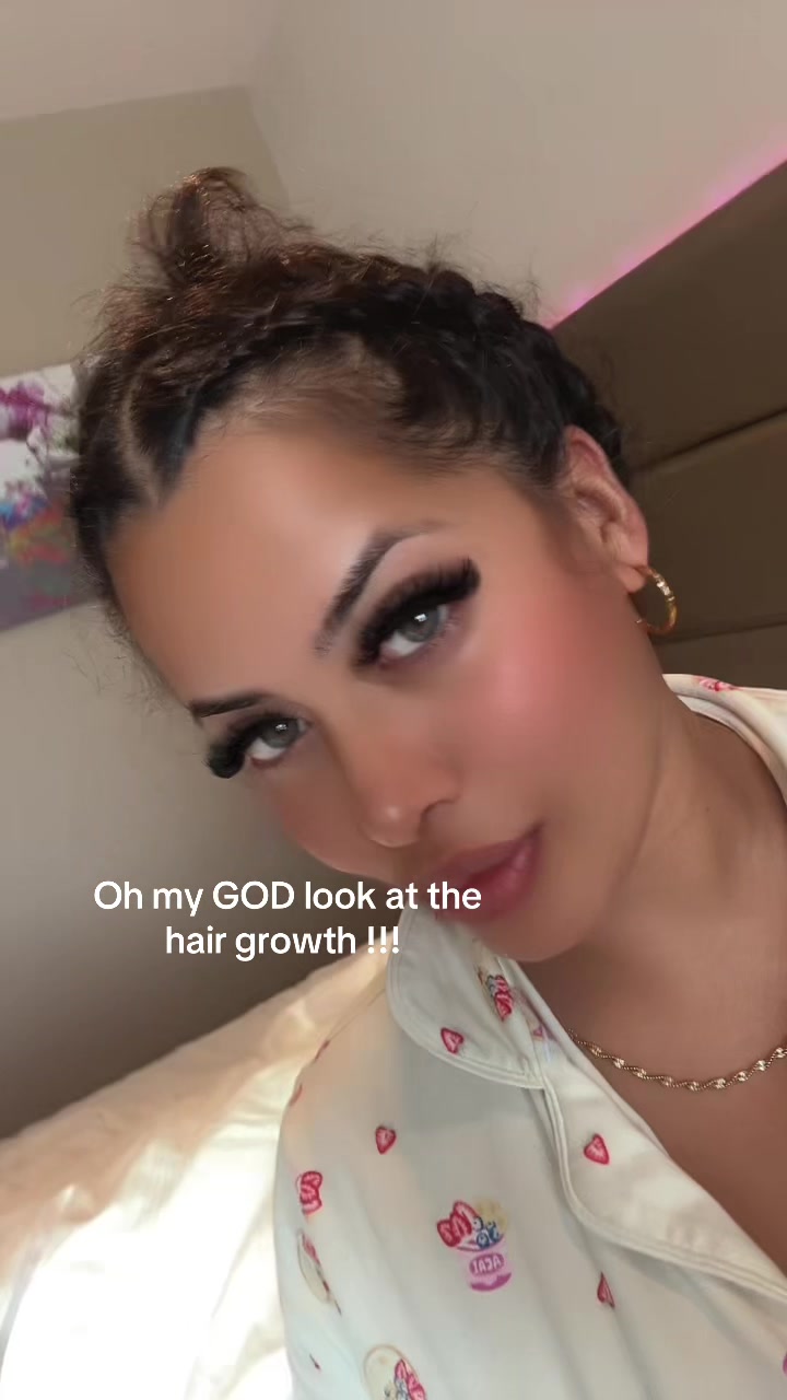 @Skylar’s Story