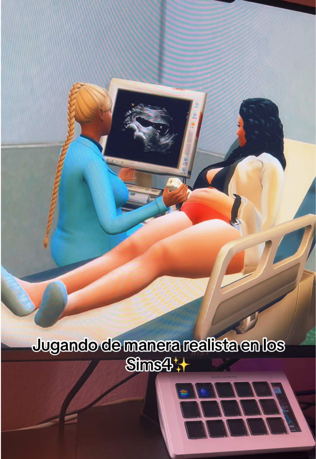 @Tu Simmer (de confianza)