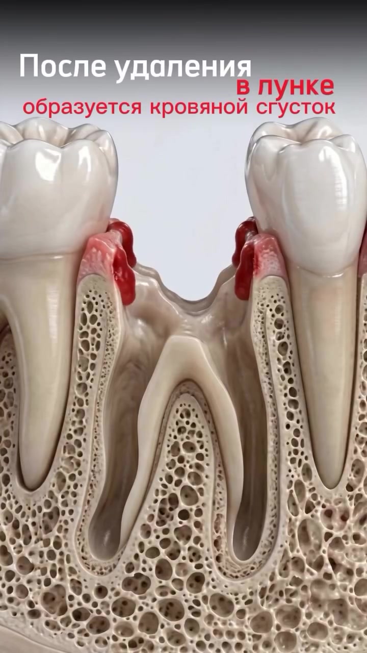 @Dent_tooth