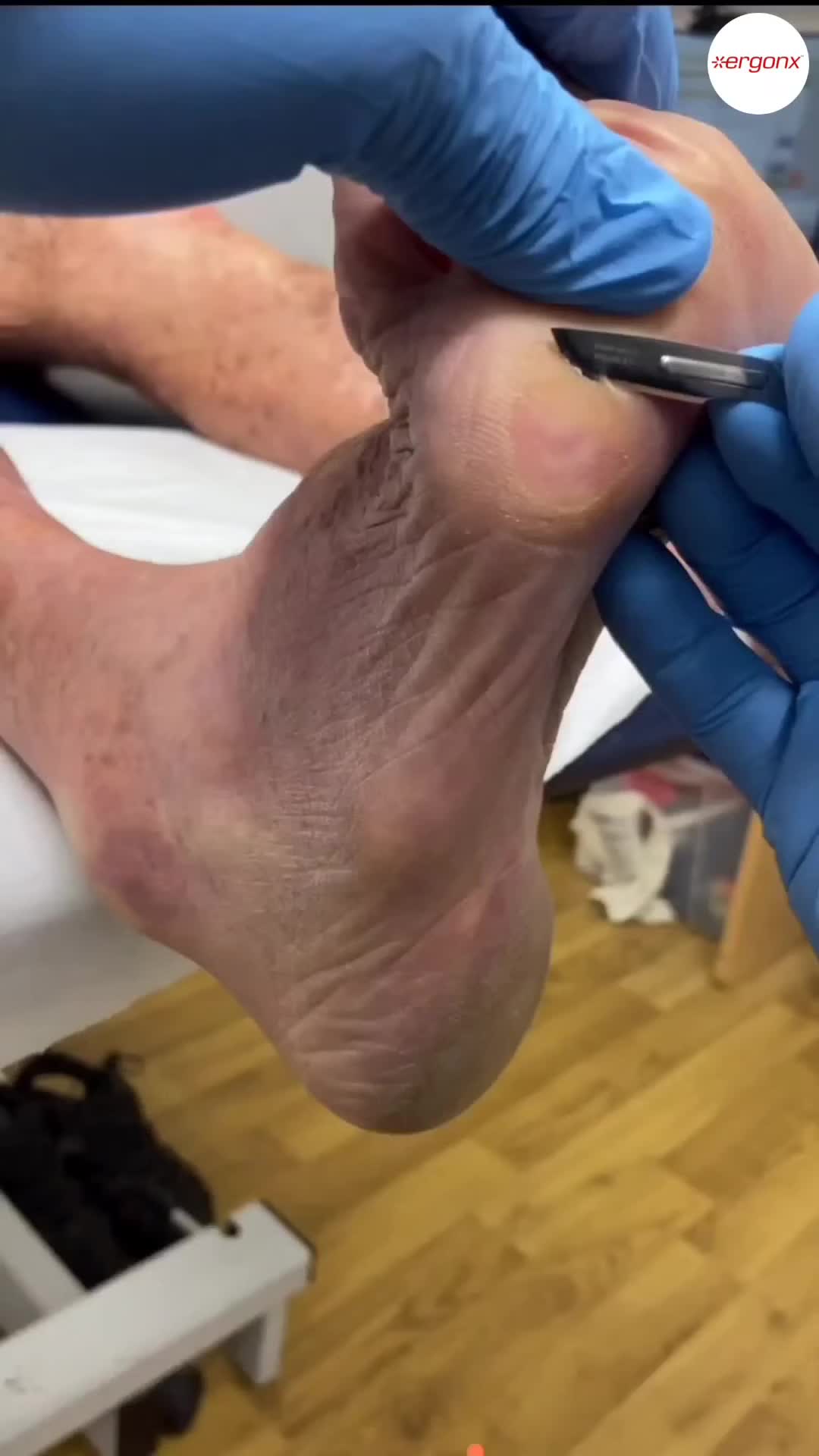 @ergonx