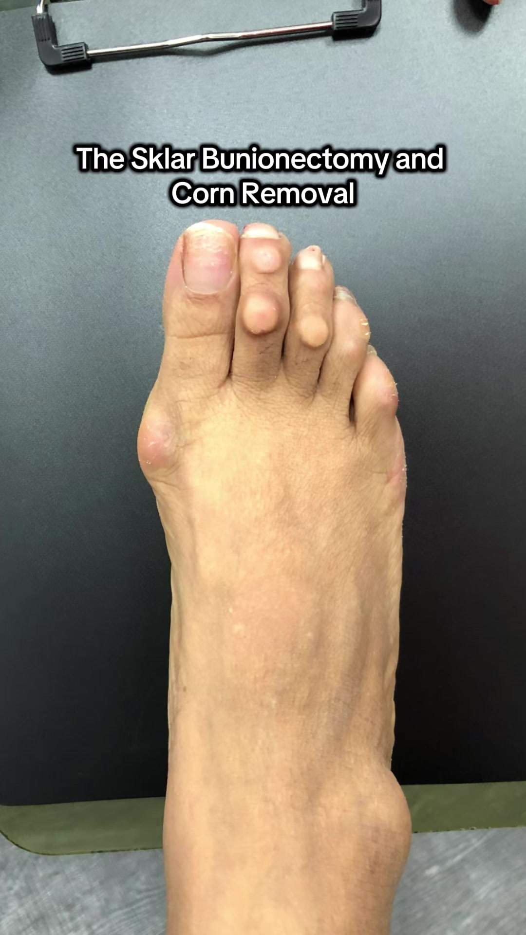 @Foot First Podiatry