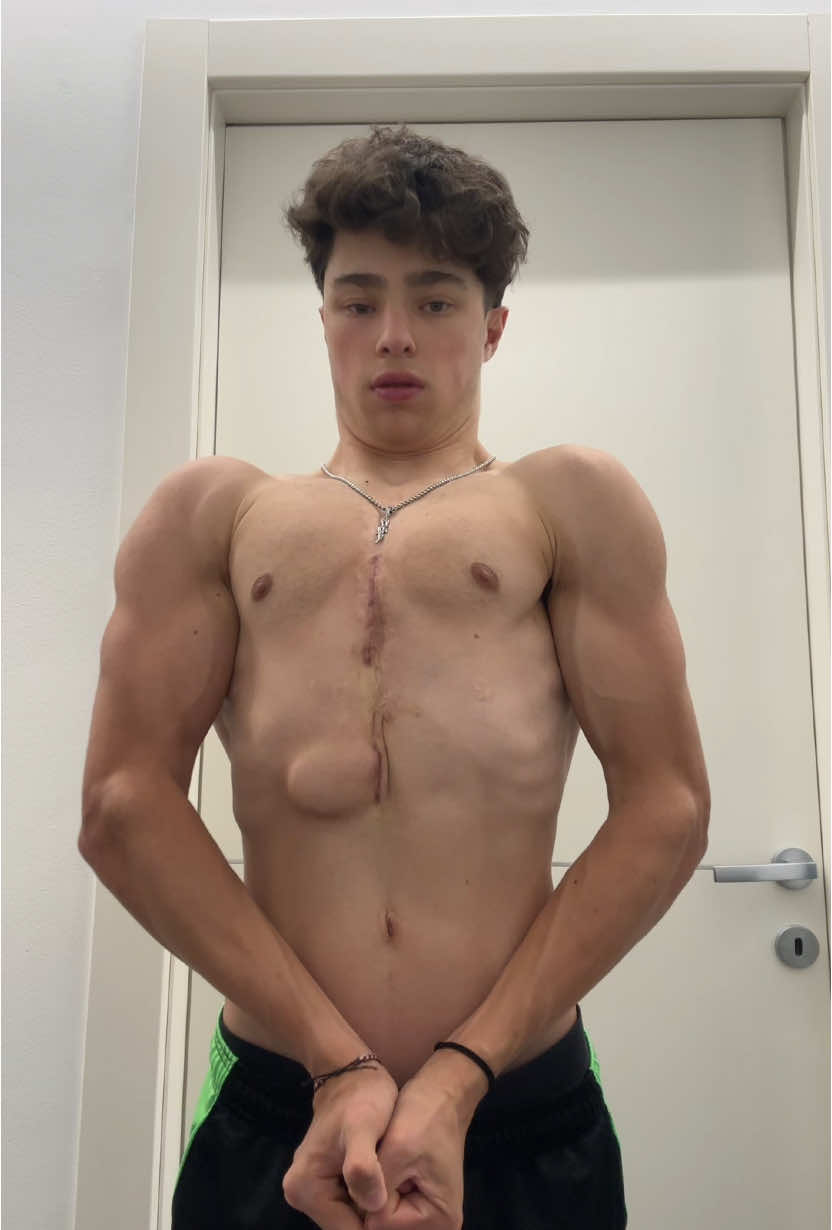 @Artu.pale