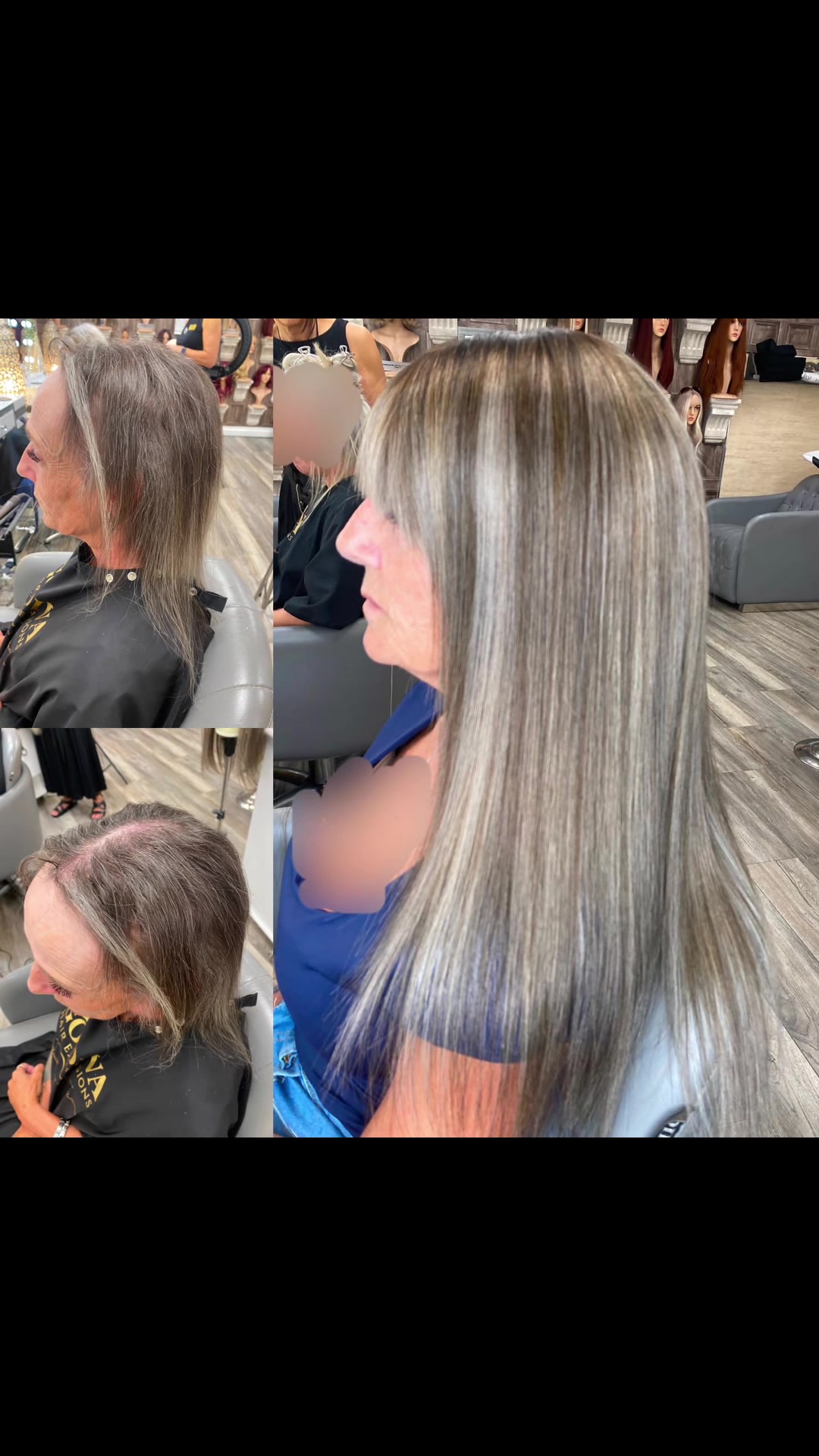 @Godiva Hair Loss Specialists
