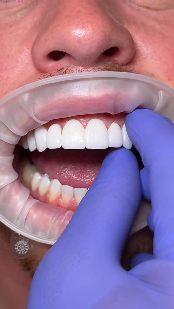 @Dentalexcellenceuk