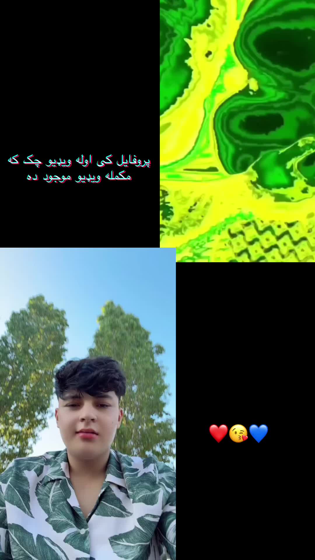 @🥺Ziba 🫠 Ahmadzai 💜💘