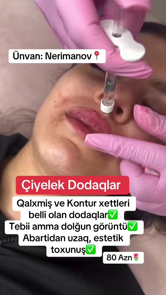 @Kosmetoloq_G&uuml;l&uuml;_Rajab