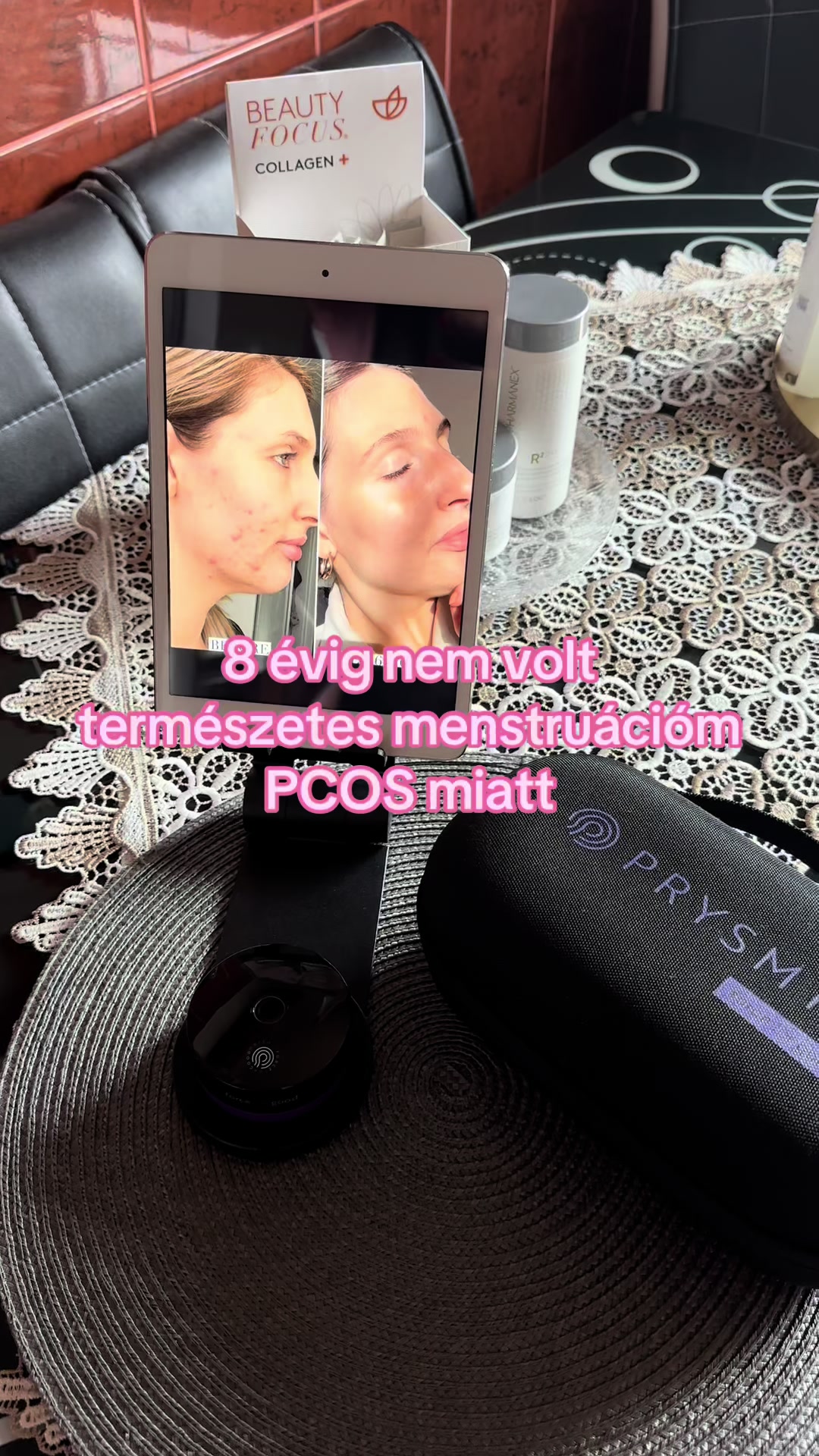 @ℤ𝕤𝕦𝕫𝕤𝕜𝕒 𝕀𝕞𝕣𝕖 💎