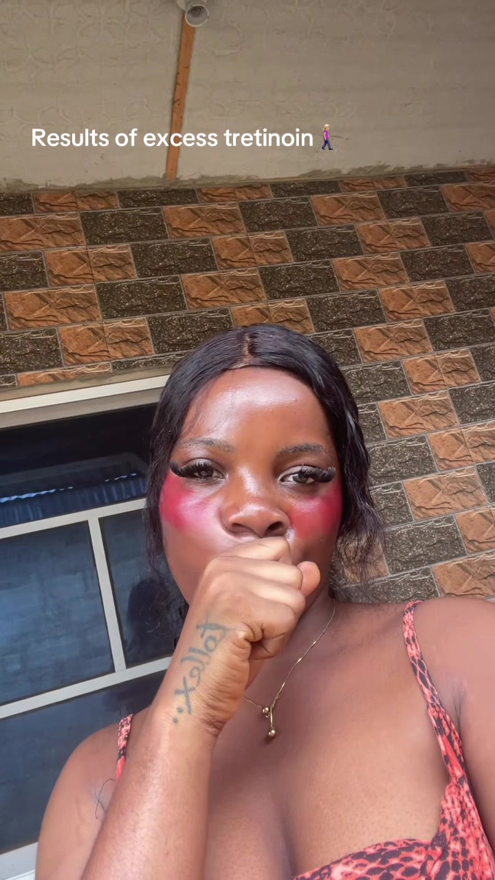 @꧁༆Kwen Tollex🥹🦋🌸 ༆꧂