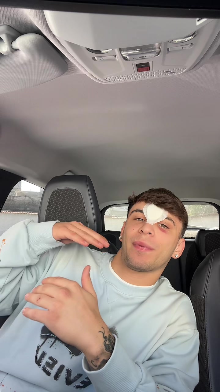 @Alessandro