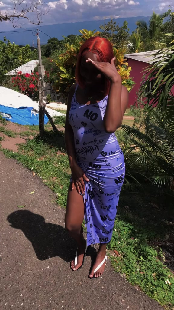 @1 Dana exclusive