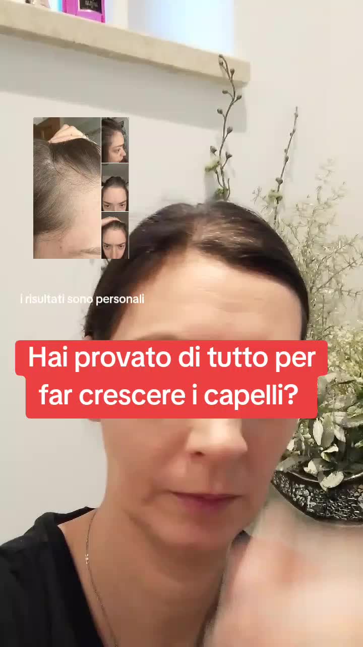 @iry crescita capelli