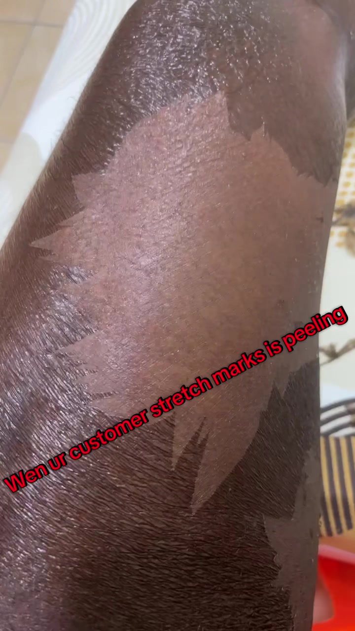 @@ Precious peeling soap
