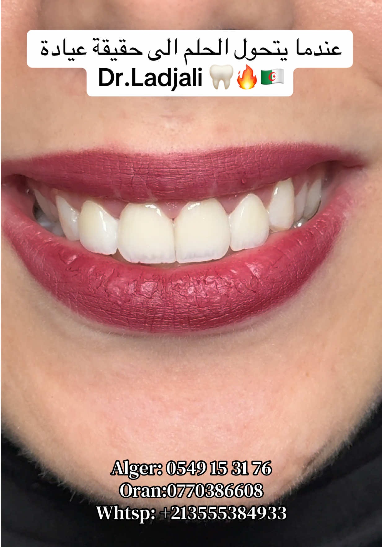 @Dr.ladjali