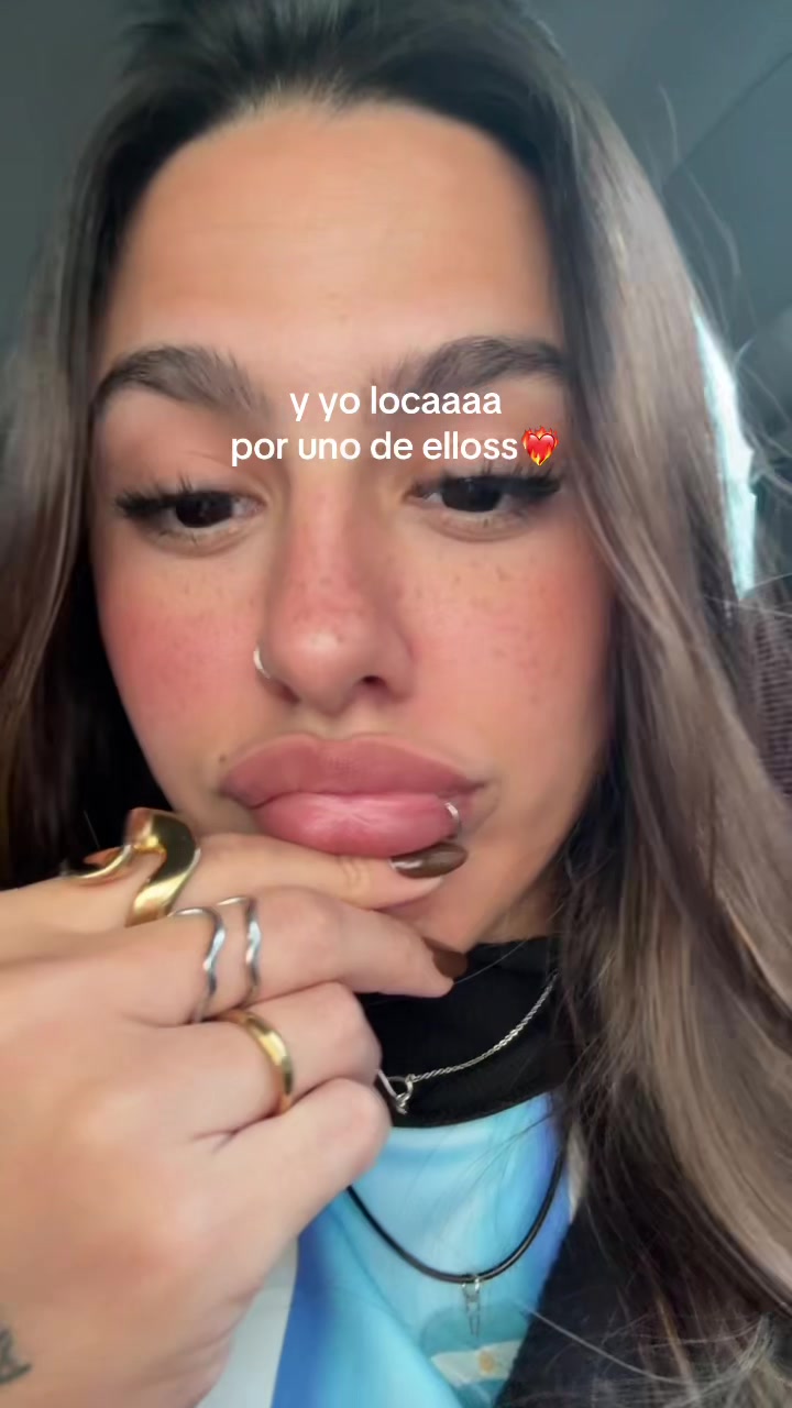 @Fiochi