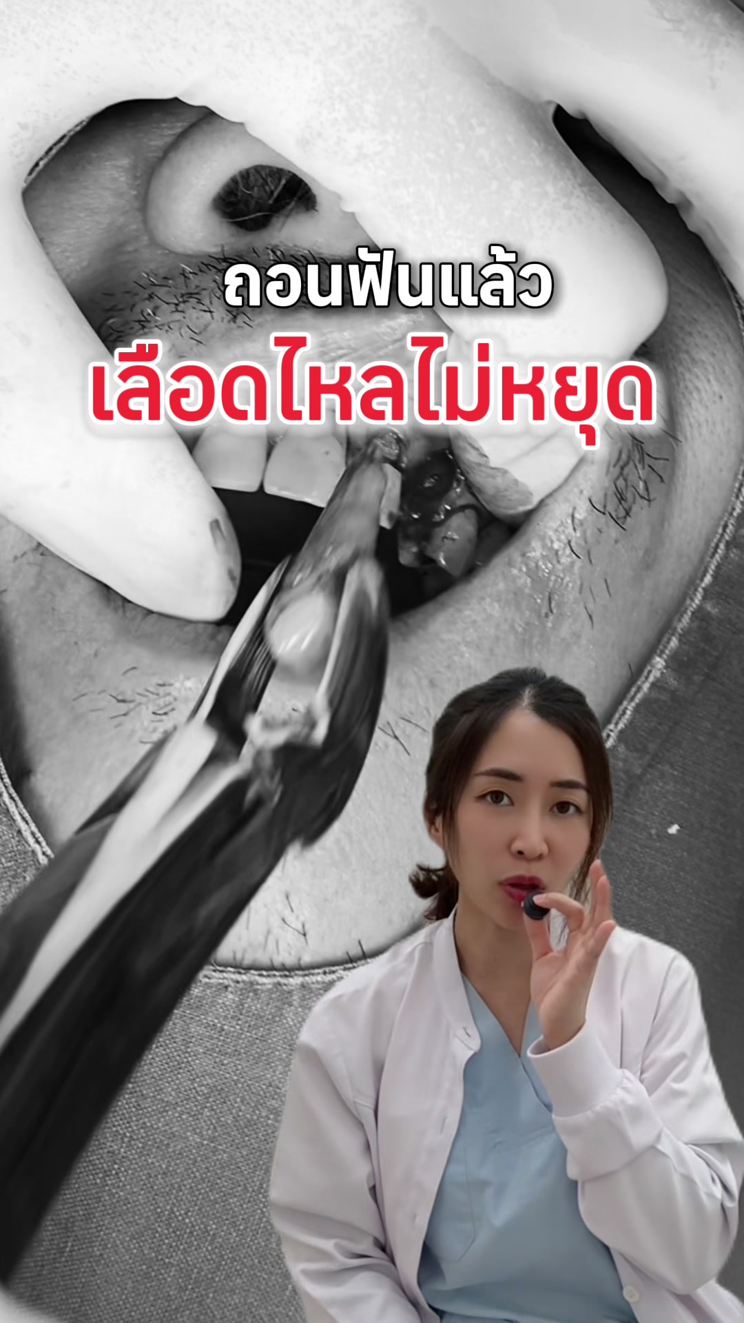 @ณัฐคุณ (Nuttakul Dent) 🦷