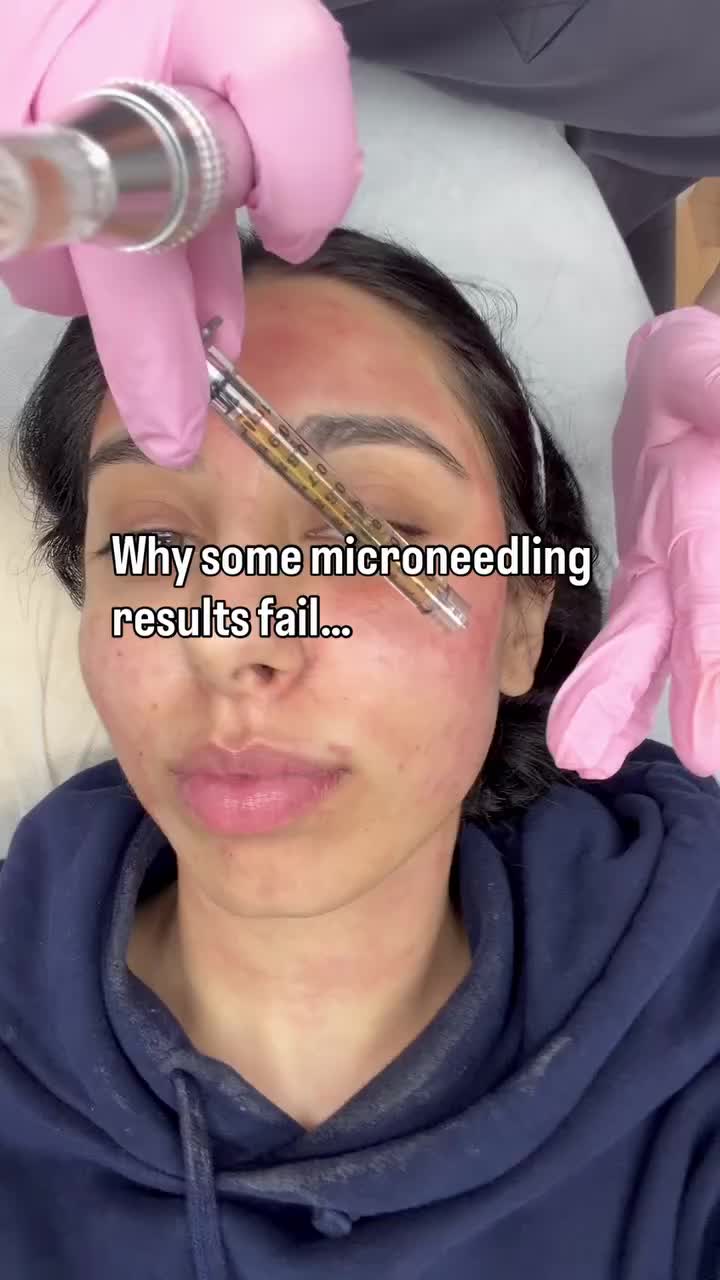 @ib_therapy
