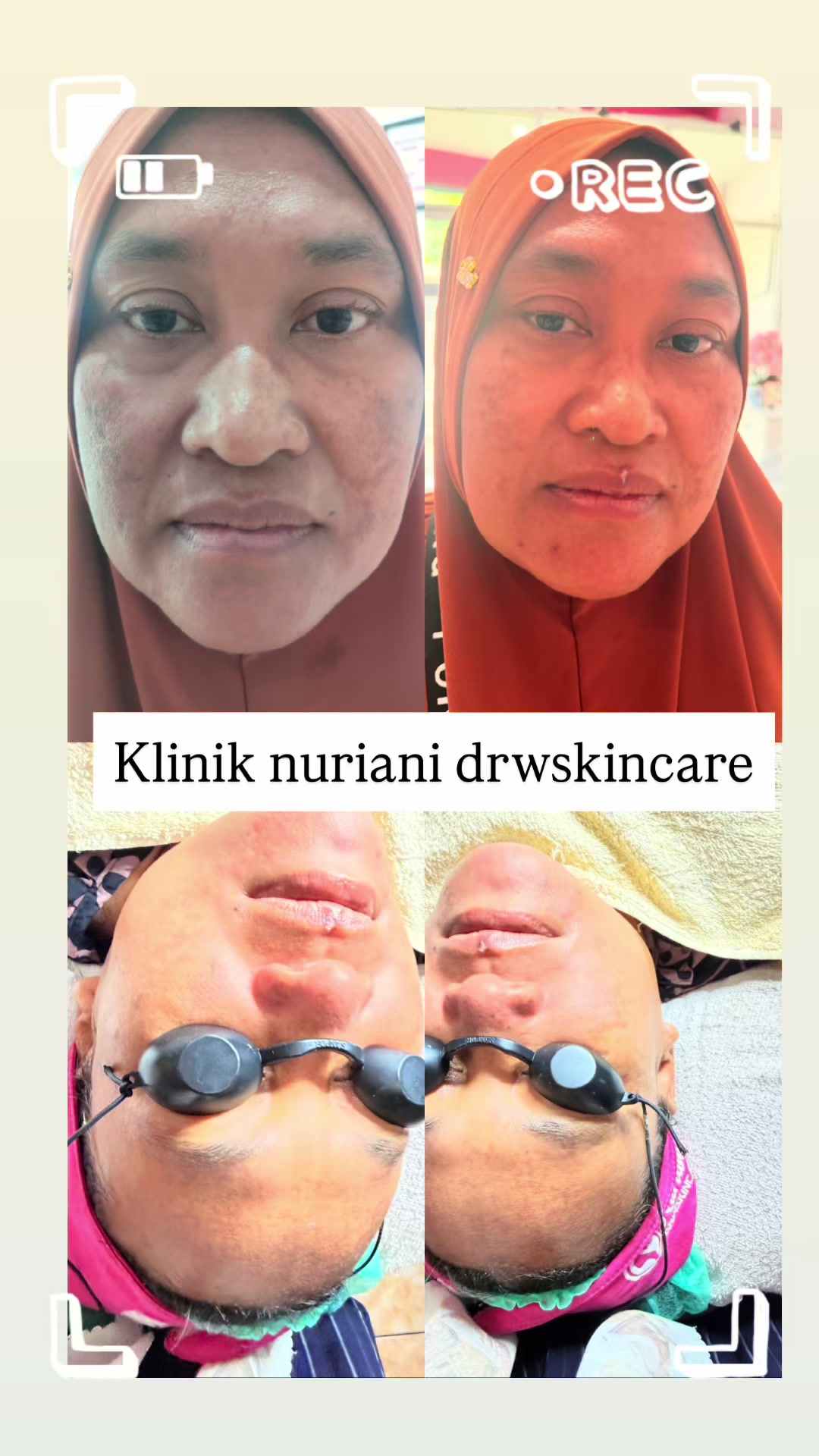 @Klinik drwskincare Sumut