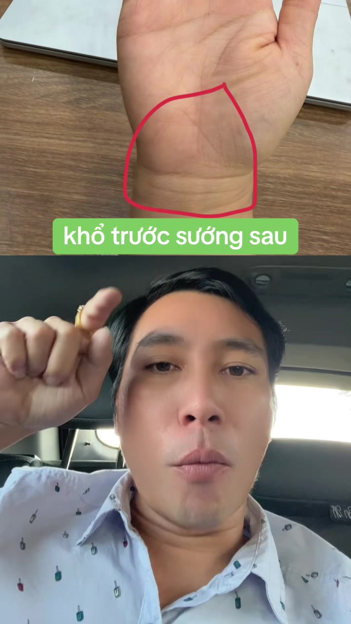 @Tuệ Nhãn ✅