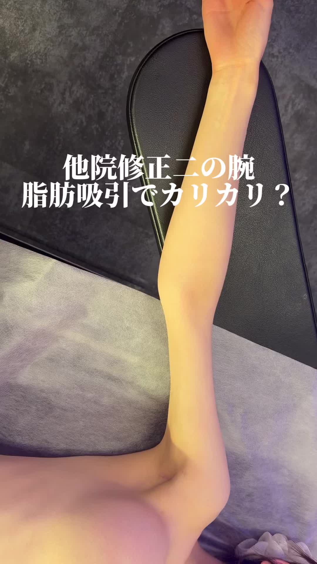 @森脇進/二の腕脂肪吸引・豊胸/AVAN TOKYO