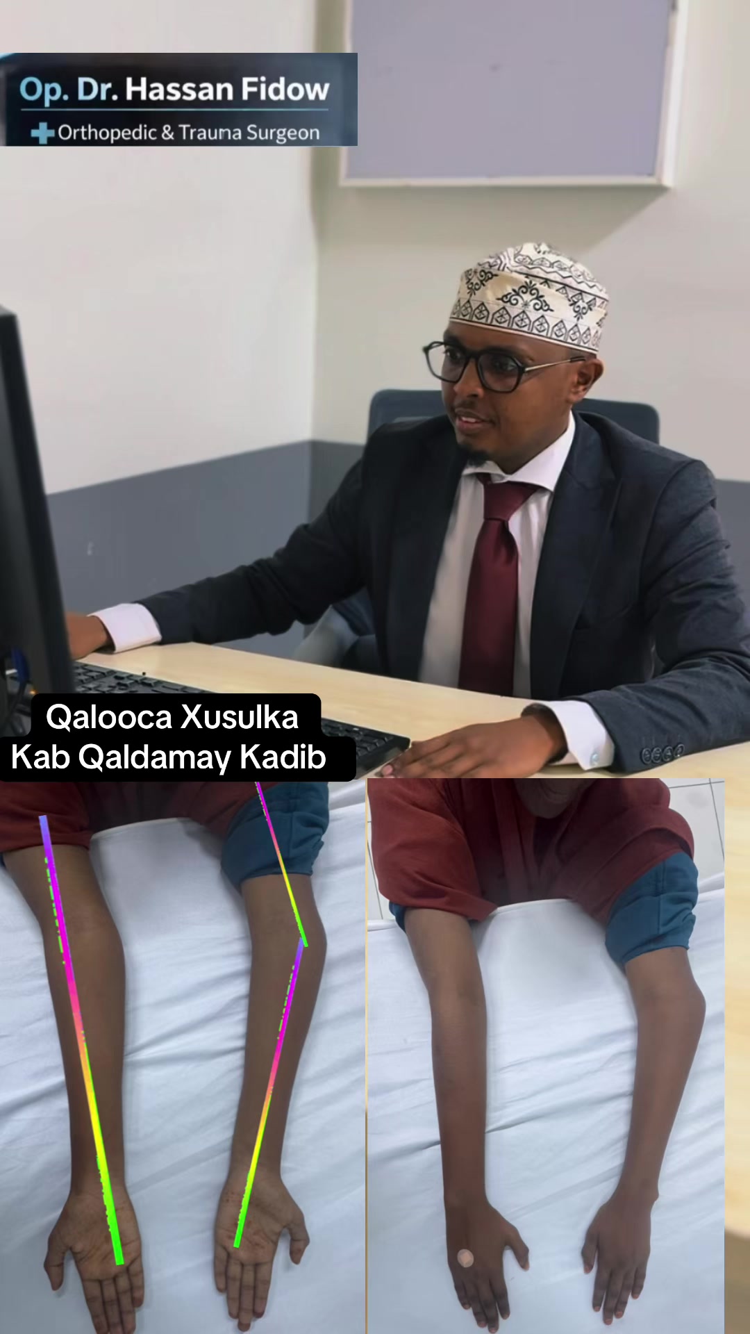@DrHassan Fidow