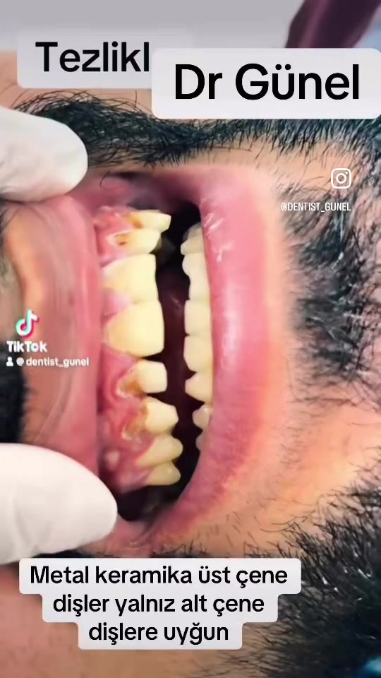 @Dentist_Günel