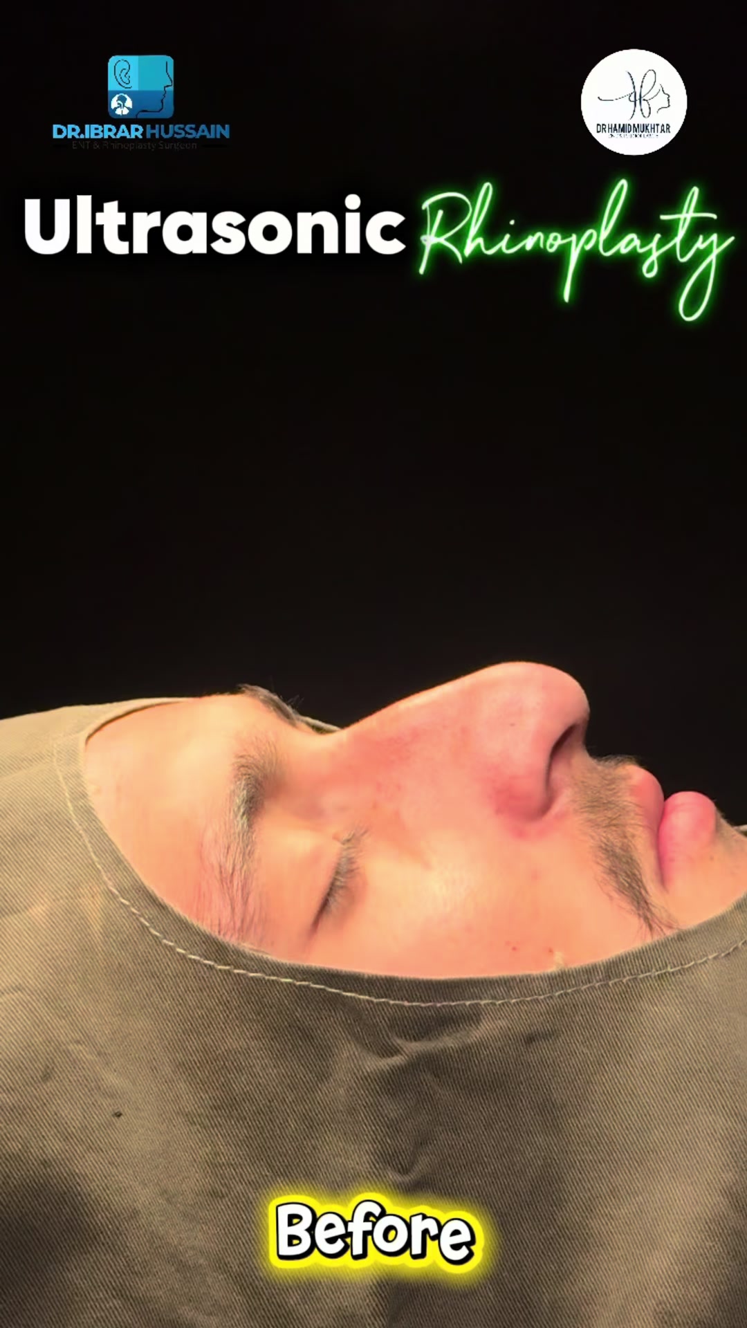 @Dr Ibrar ENT & Rhinoplasty