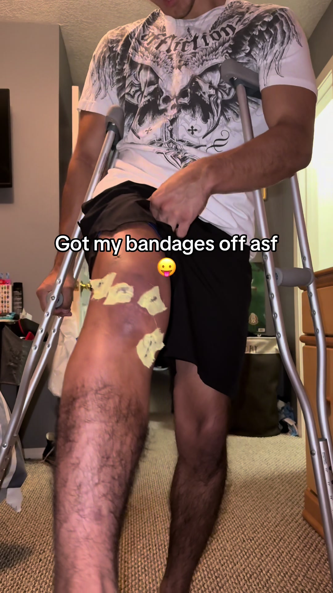 @ErickLMV