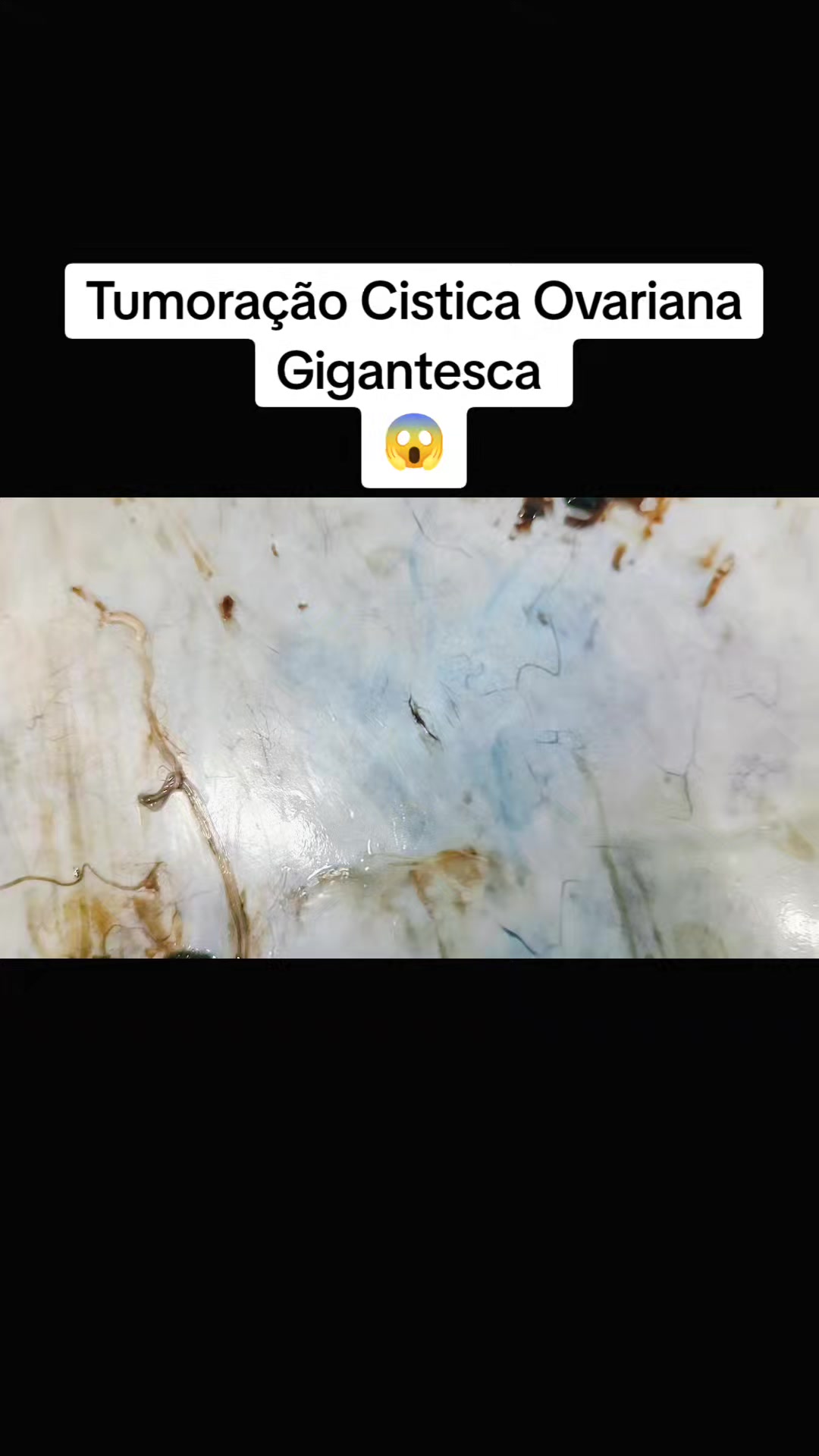 @Jeferson7199