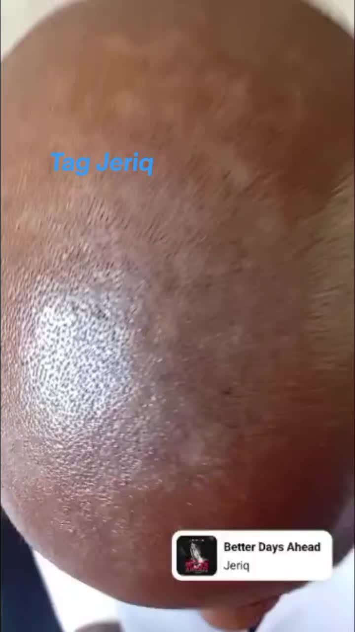@OG FX