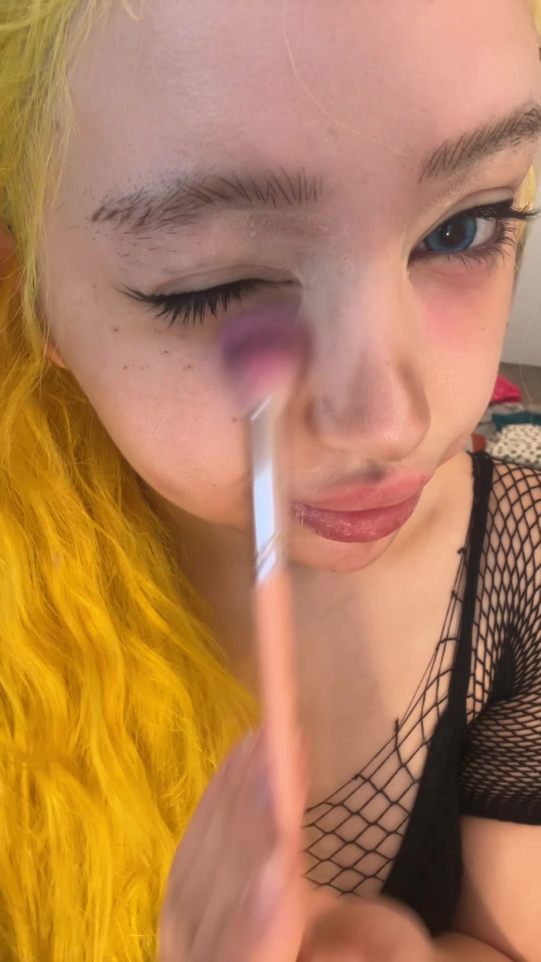 @Anoi