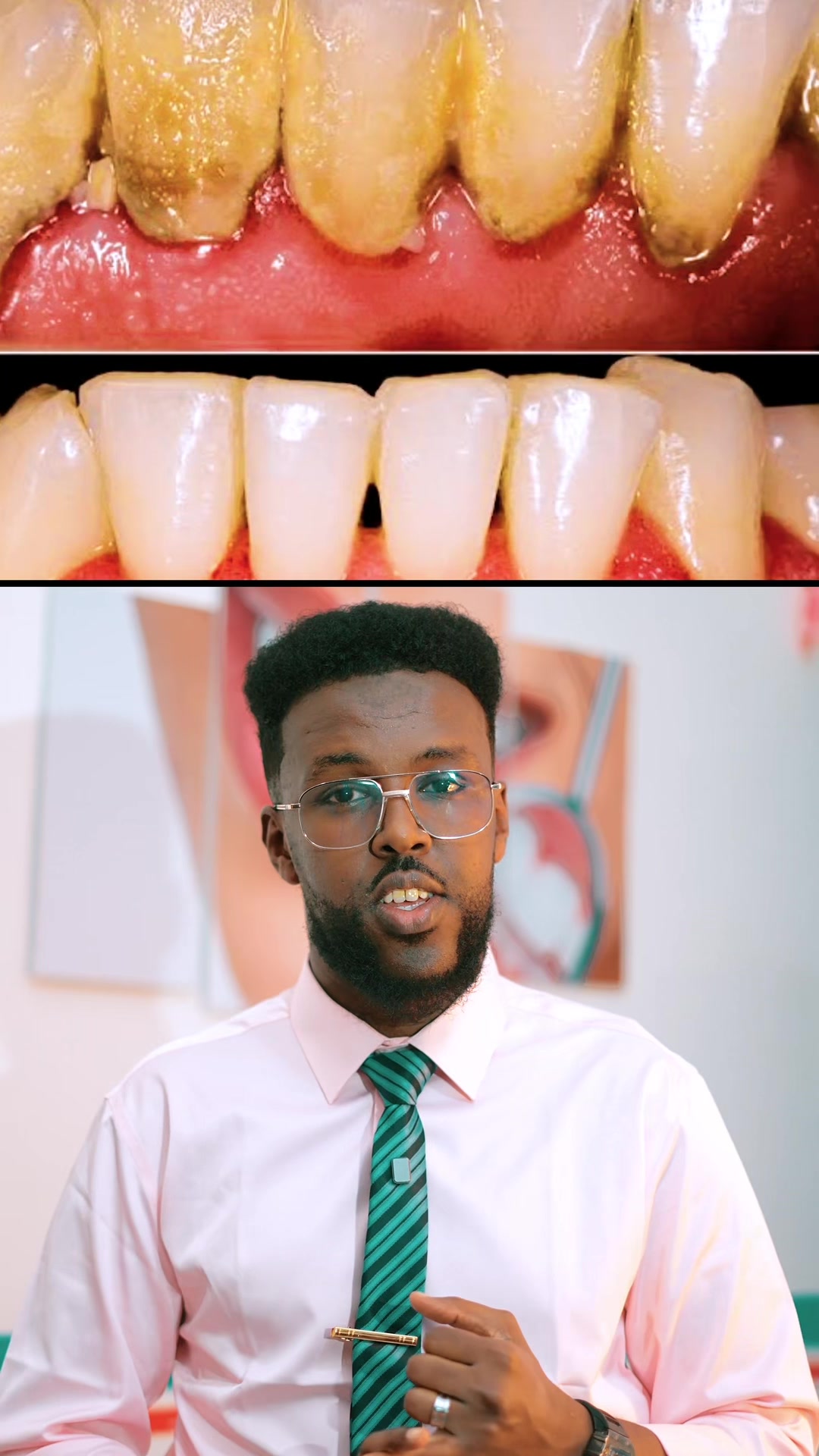 @Dr. Maano 🦷