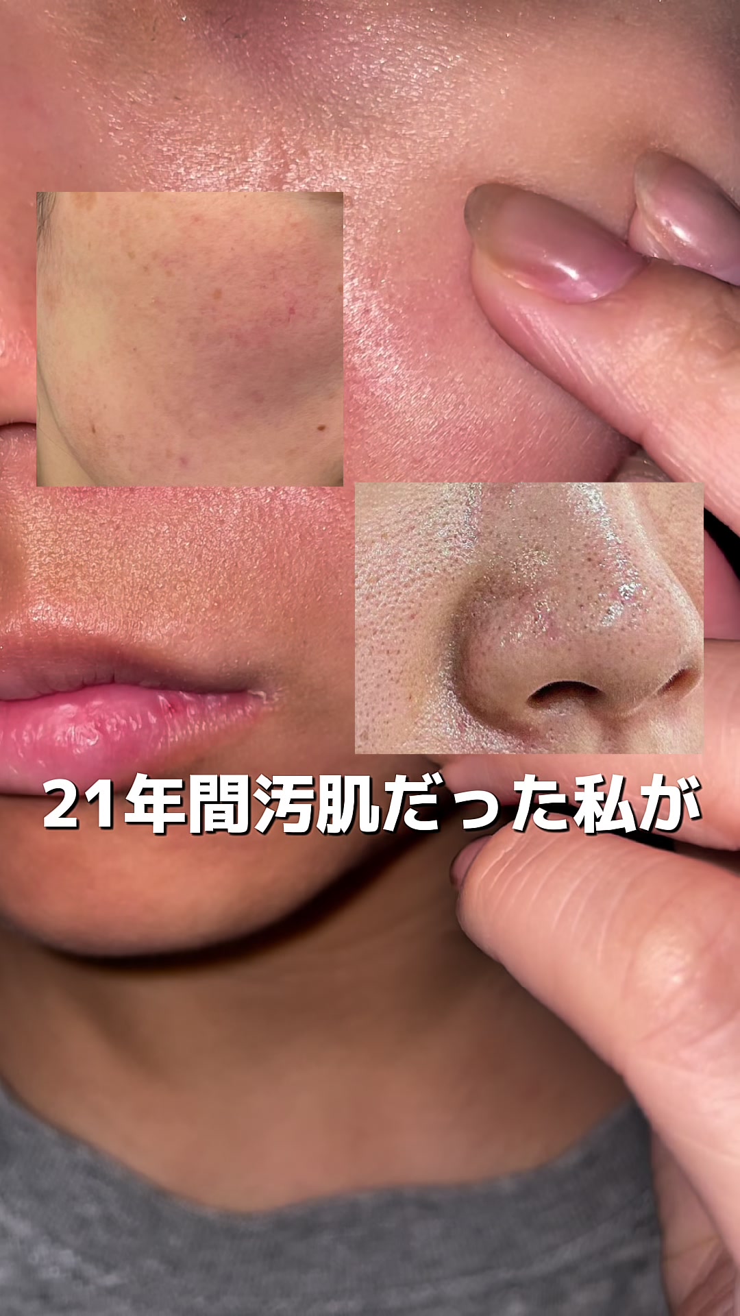 @ラティオス