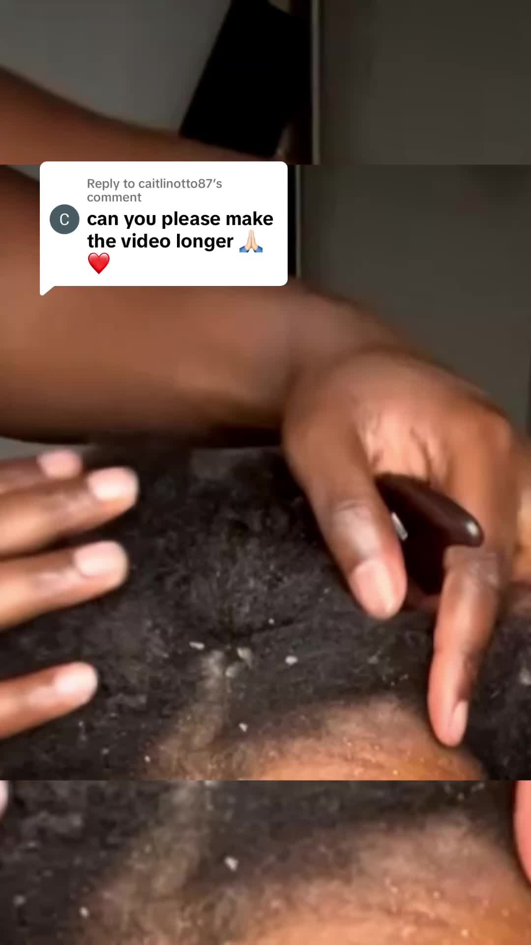 @DDF