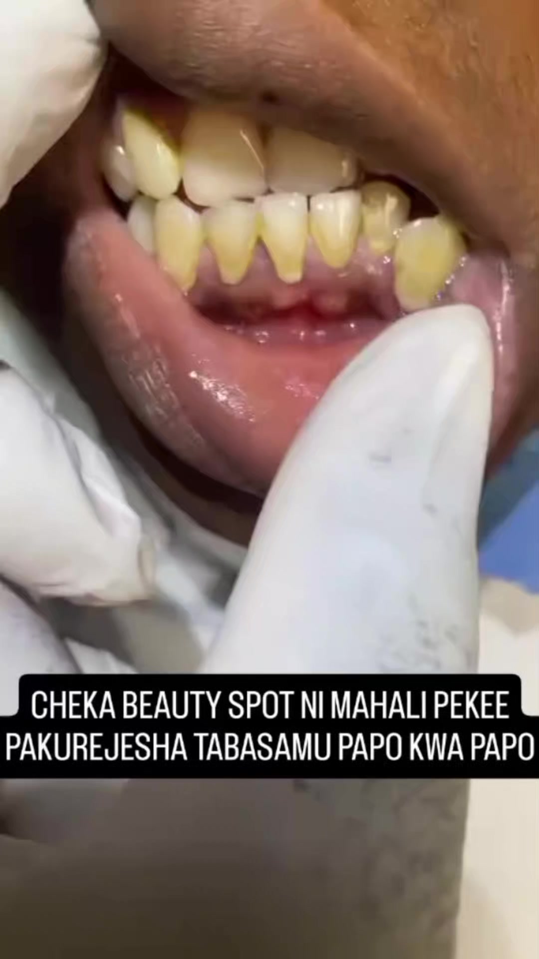 @Cheka Beauty Spot