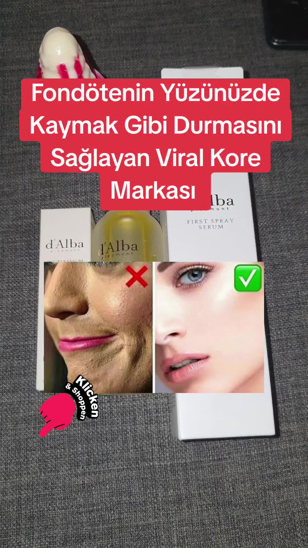 @Gurbet Ana