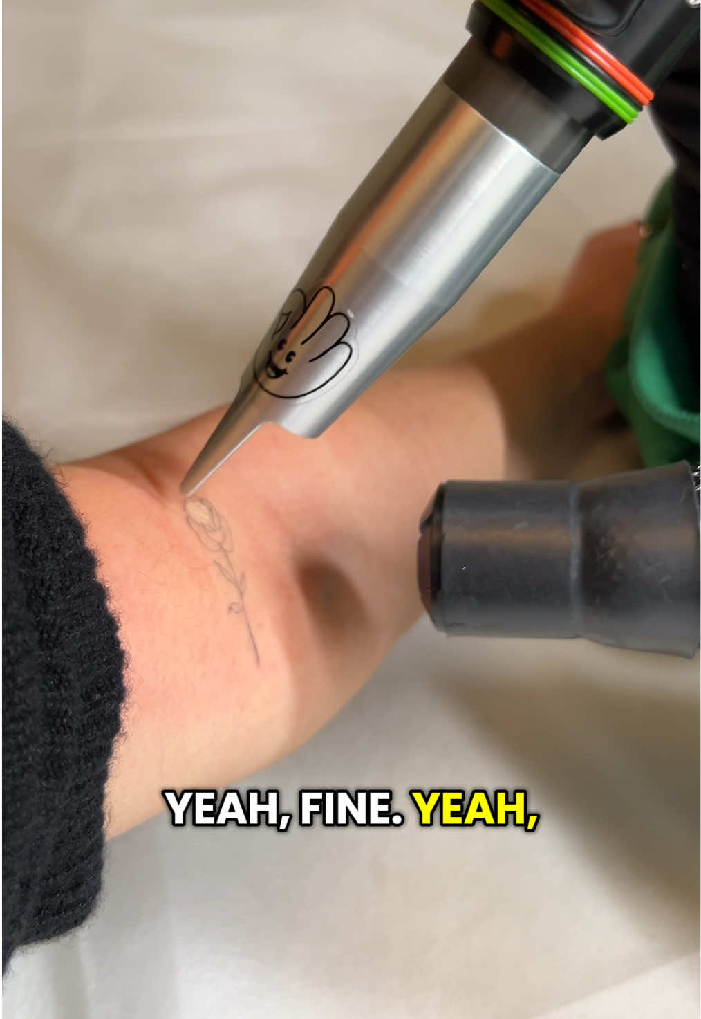 @Swift_tattoo_removal