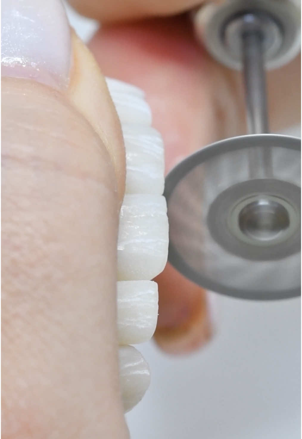 @Vivo Dental Lab