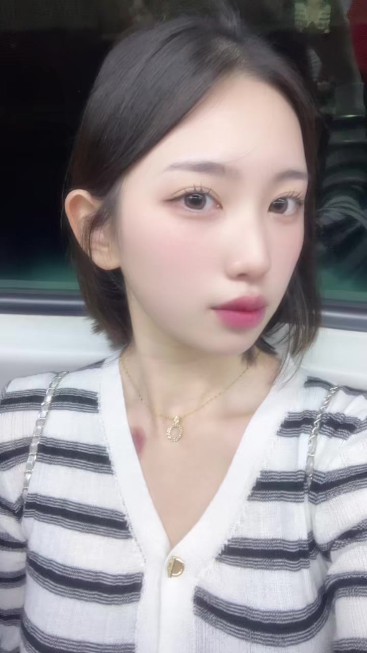 @ㅈㅇㄴ