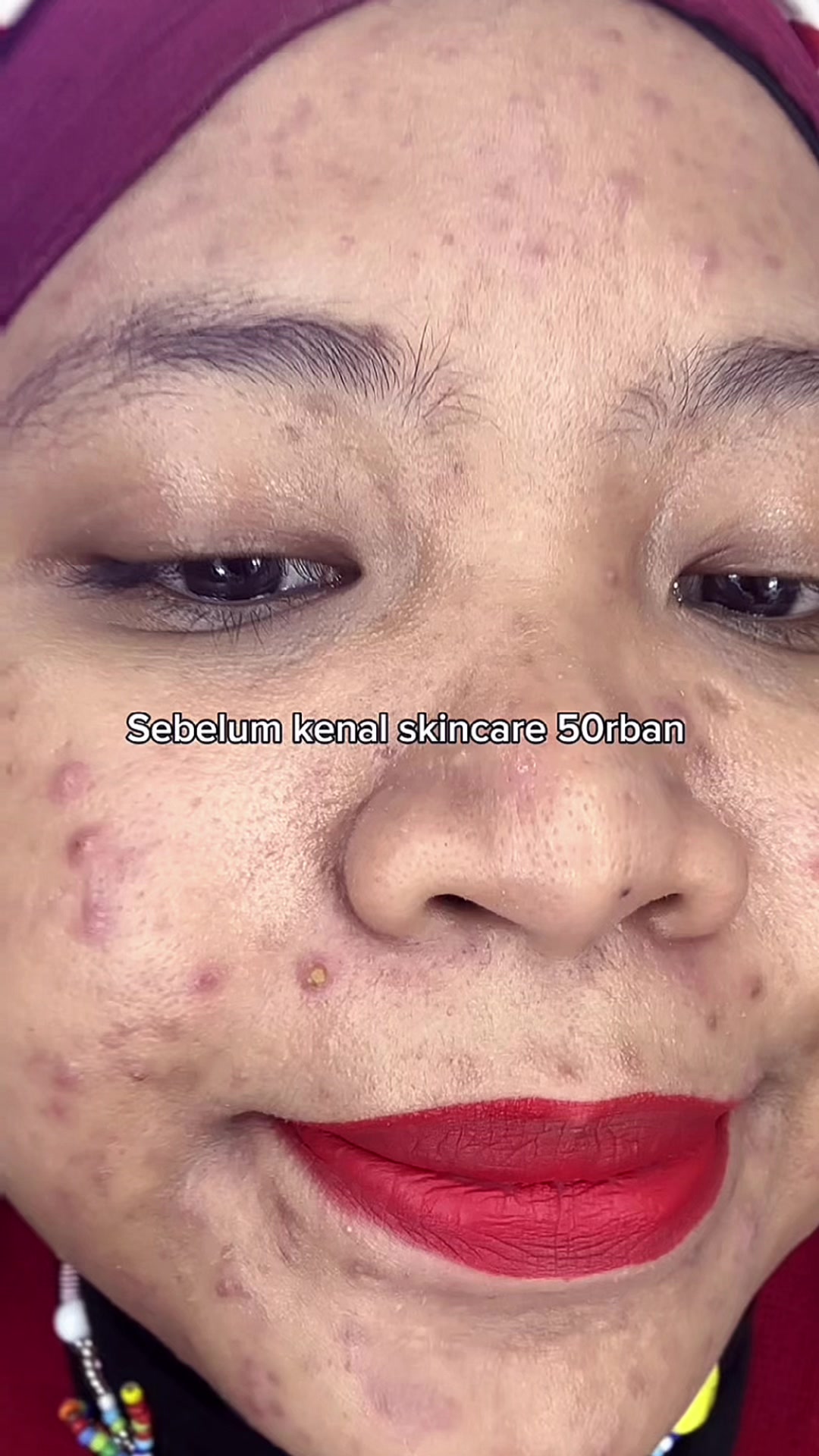 @MBAK CUNGCAT BAYI