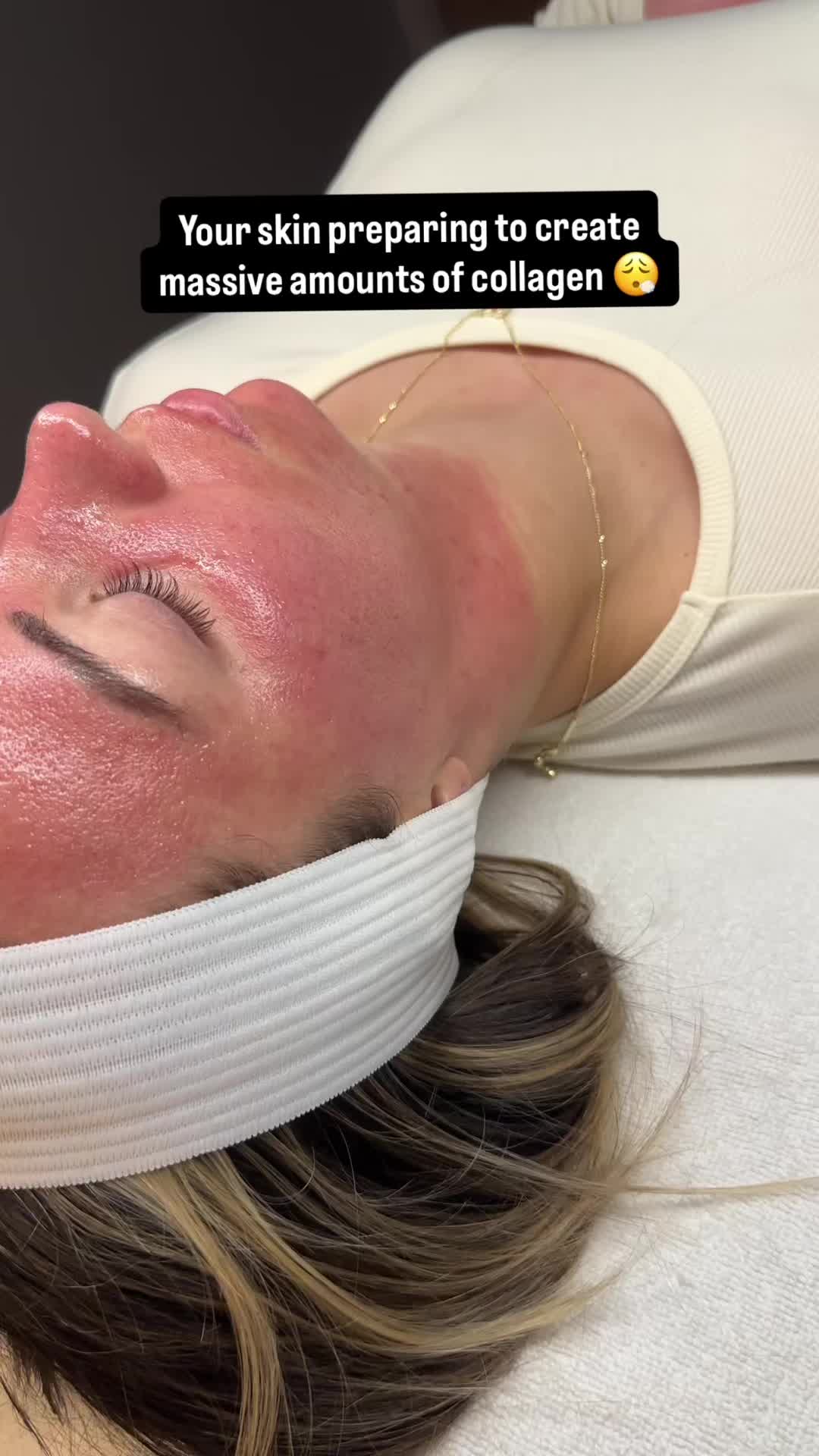 @Mikayla | Esthetician