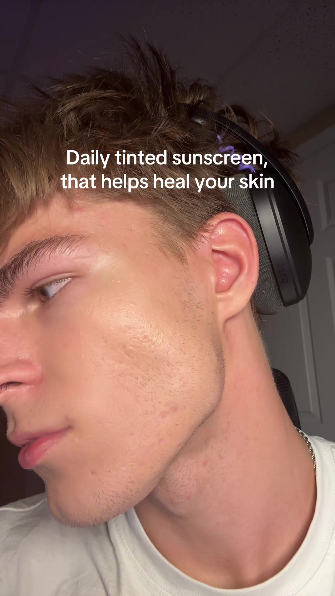 @Finn