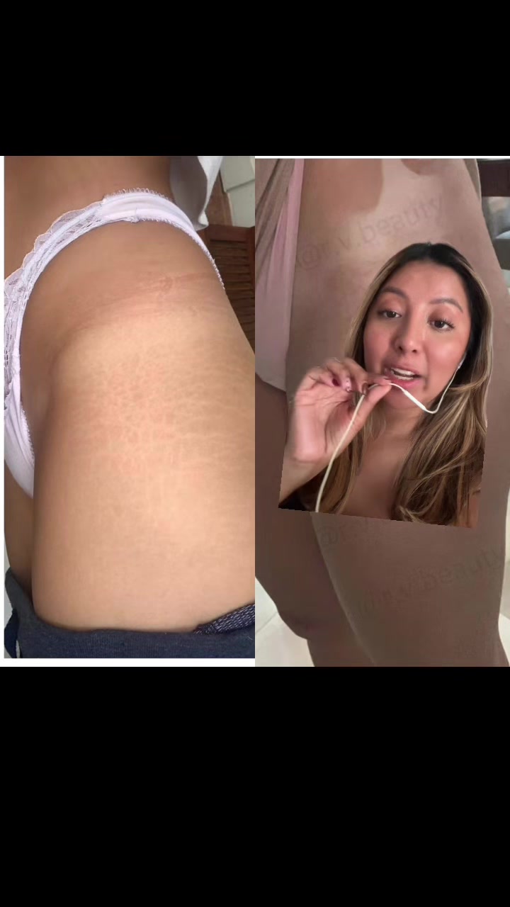 @Carla Panchana