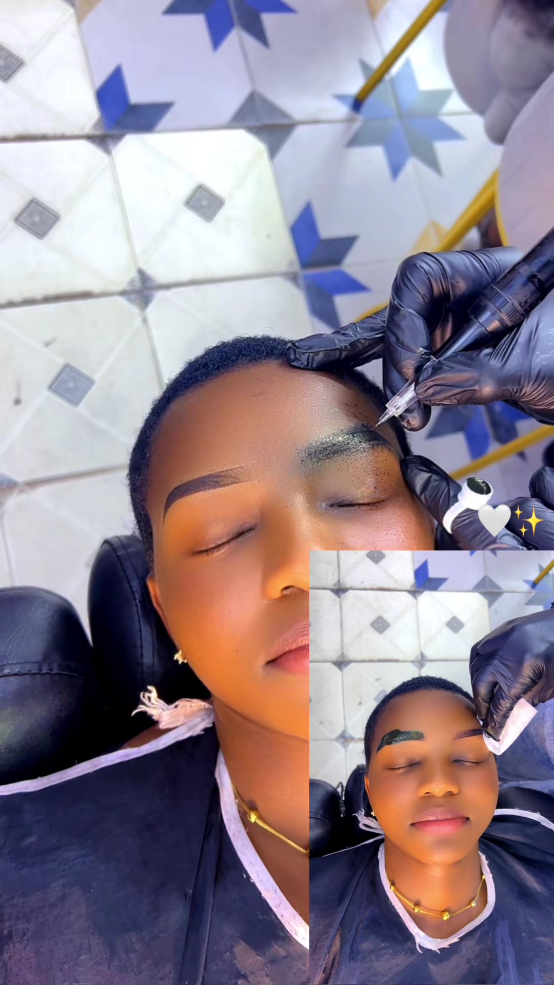 @Dr.eyebrows1