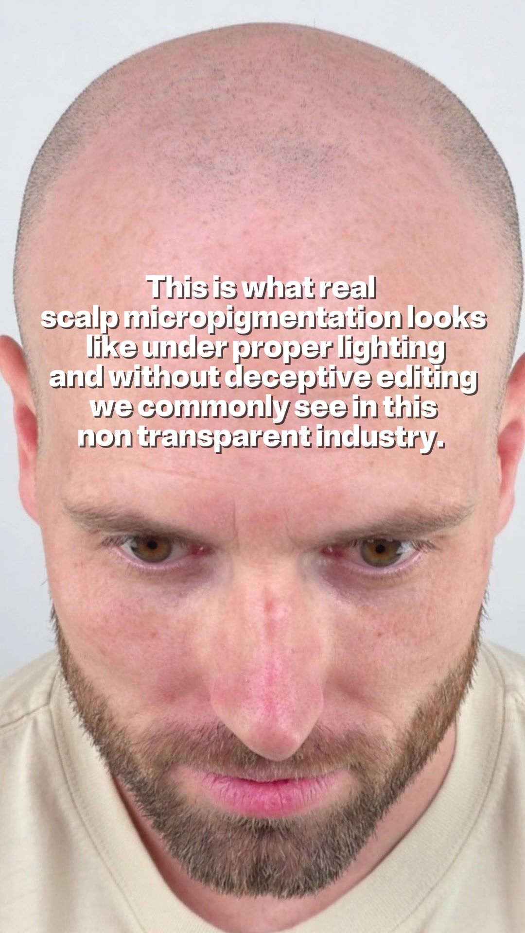 @Enhanced Scalp
